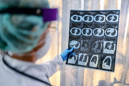Healthcare professional looking at lung images. Media Source: MedPageToday